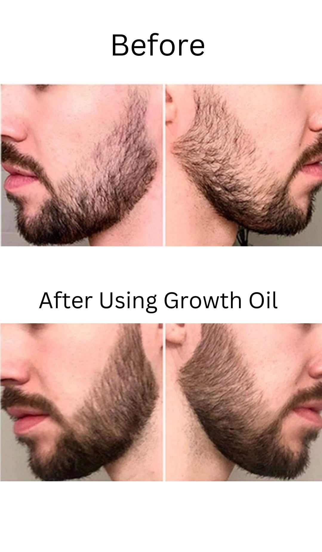 BEARD GROWTH OIL